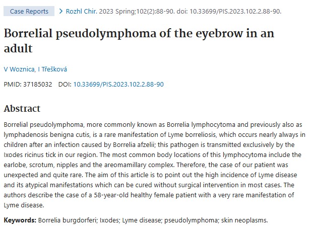 Borrelial pseudolymphoma article